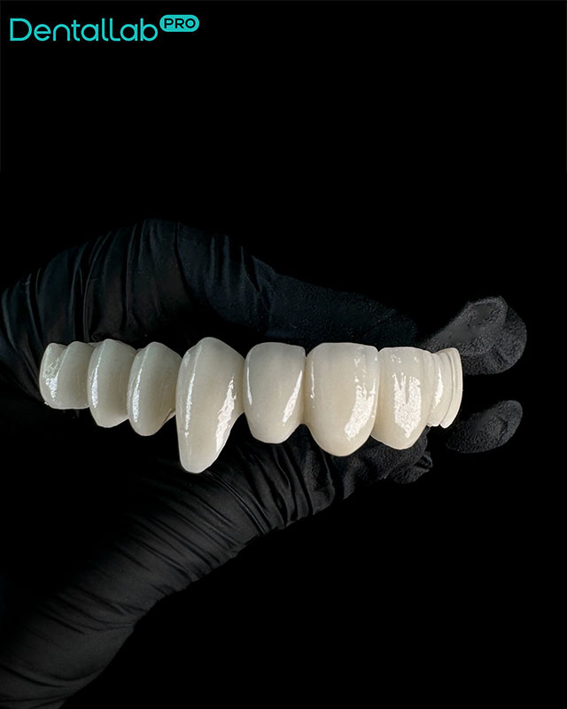 Most dwunastopunktowy pełnoceramiczny.