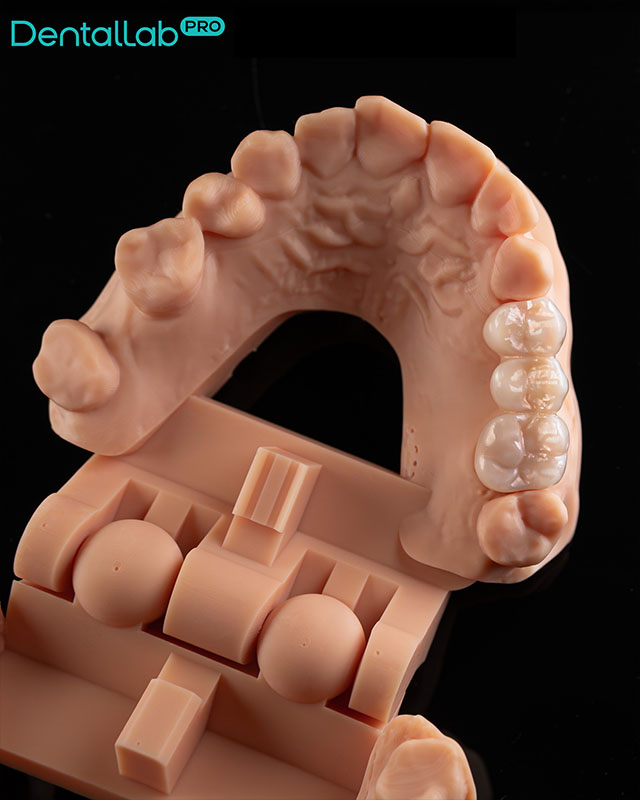 Most pełnokonturowy.