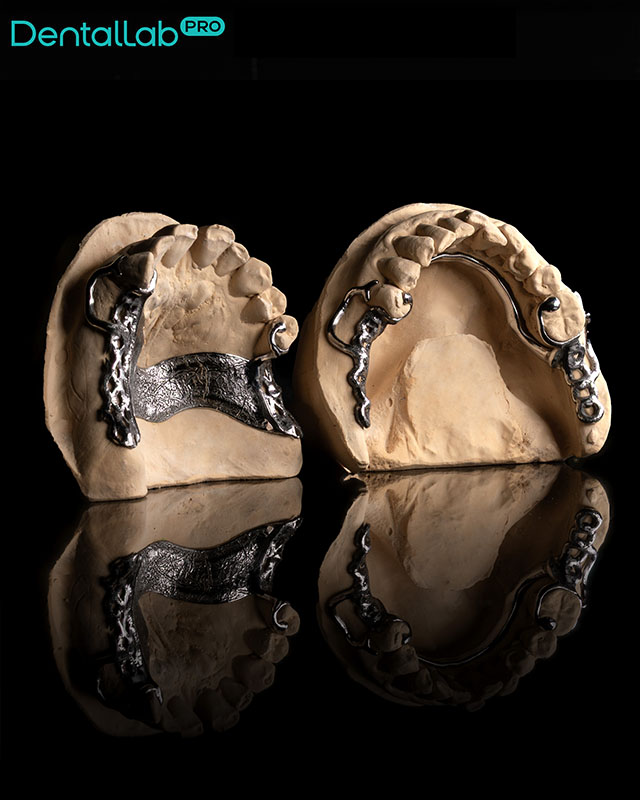 Konstrukcja szkieletowa.