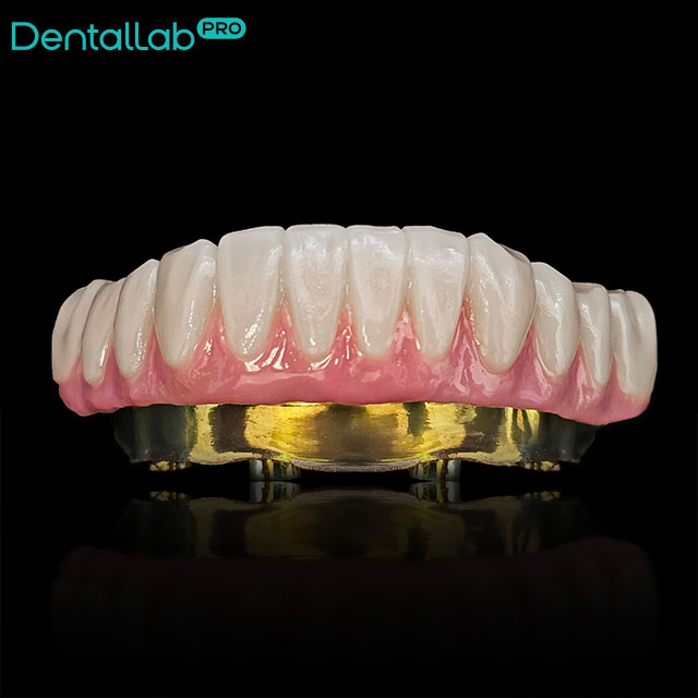 Suprastruktura Prettau.