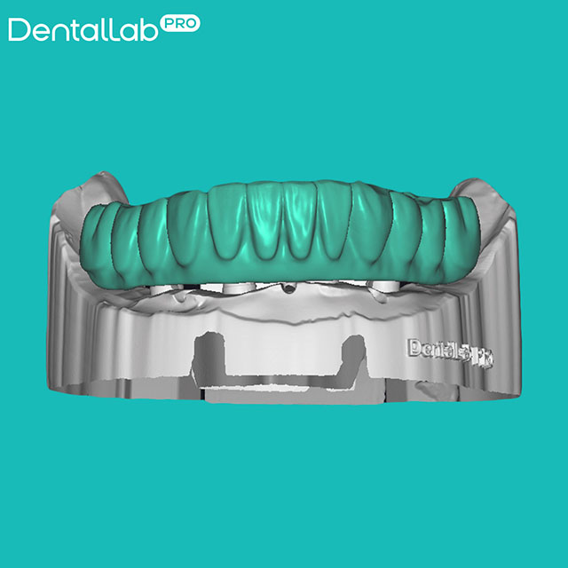 Suprastruktura Prettau.