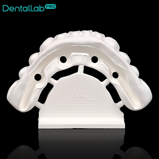 Suprastruktura Prettau.