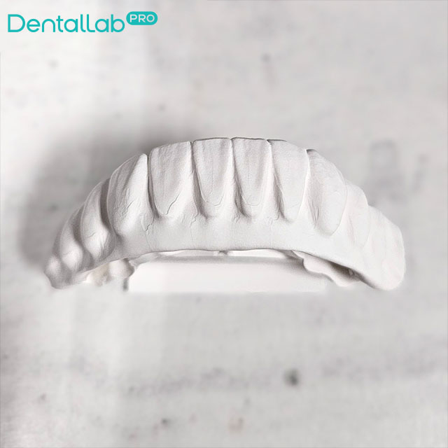 Suprastruktura Prettau.