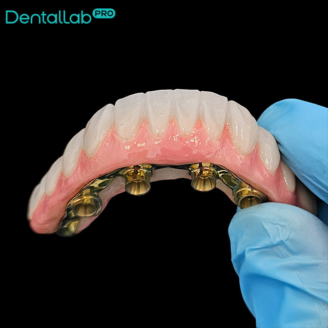 Suprastruktura Prettau.