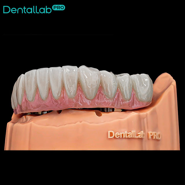 Suprastruktura Prettau.