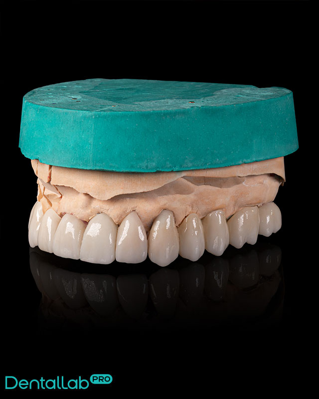 Korony i mosty pełnoceramiczne