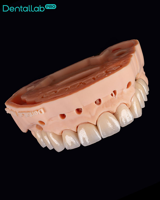  Korony pełnoceramiczne, na modelu z wyciąganymi pinami.