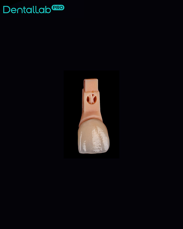  Korony pełnoceramiczne, na modelu z wyciąganymi pinami.