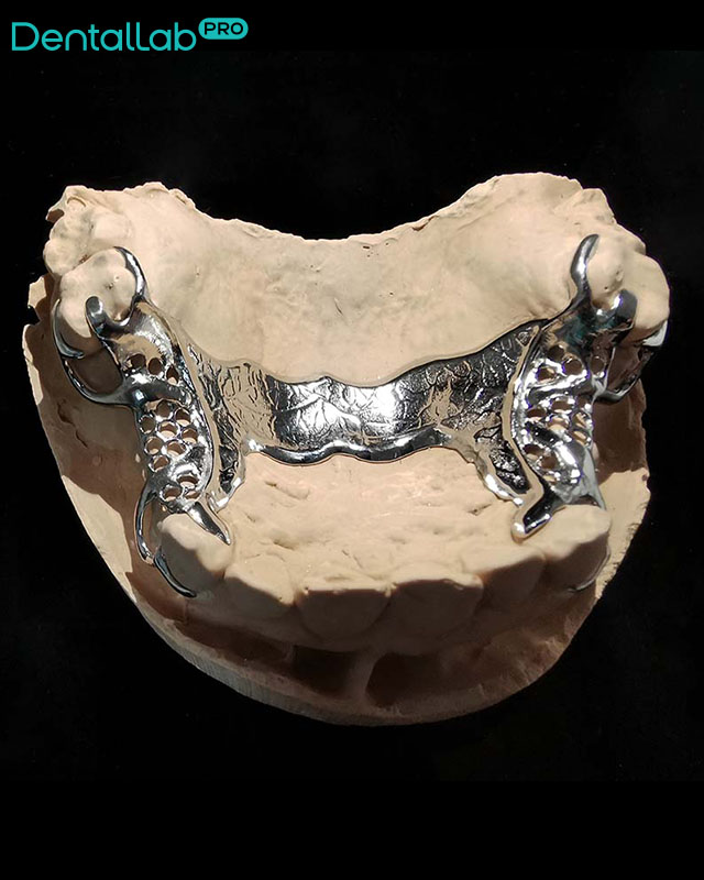 Konstrukcja szkieletowa.