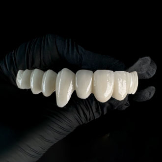 Most dwunastopunktowy pełnoceramiczny.