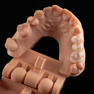 Most pełnokonturowy.