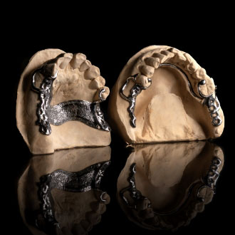 Konstrukcja szkieletowa.