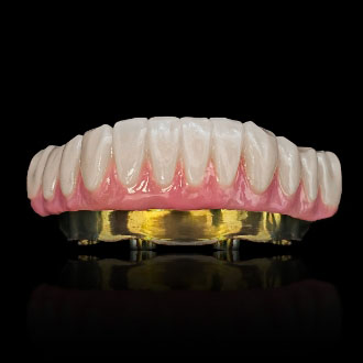 Suprastruktura Prettau.