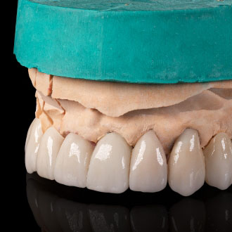 Korony i mosty pełnoceramiczne