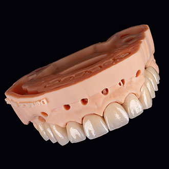  Korony pełnoceramiczne, na modelu z wyciąganymi pinami.