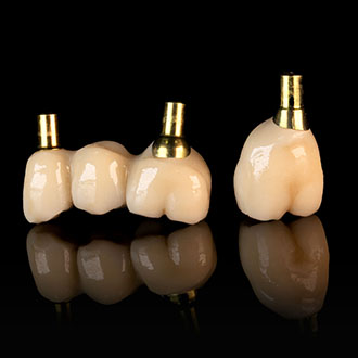  Korony ceramiczne na systemie Bicon.
