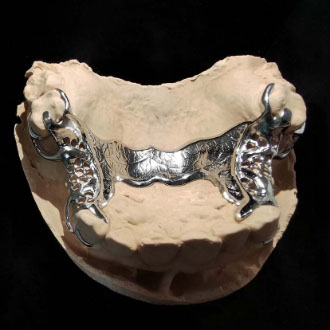 Konstrukcja szkieletowa.